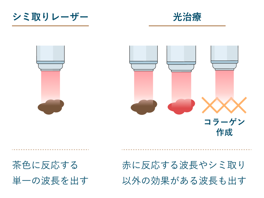 シミ取りレーザーと光治療の違い