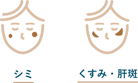 くすみ・肝斑とは