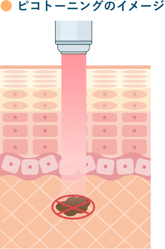 ピコトーニングのイメージ